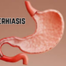 cholerhiasis